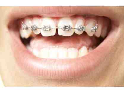 Orthodontic Treatment - $2000 off Braces or Invisalign