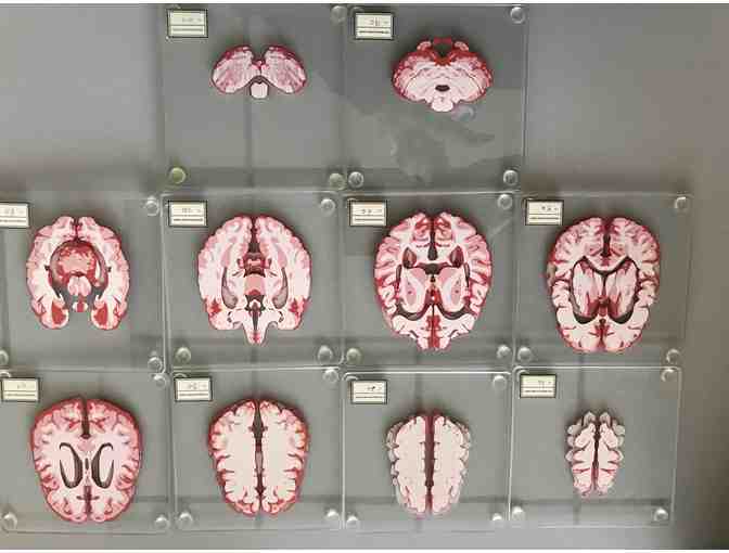 Brain sliced coasters - Photo 1