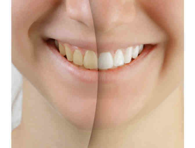 Brighten Your Smile at Biltmore Dental Center