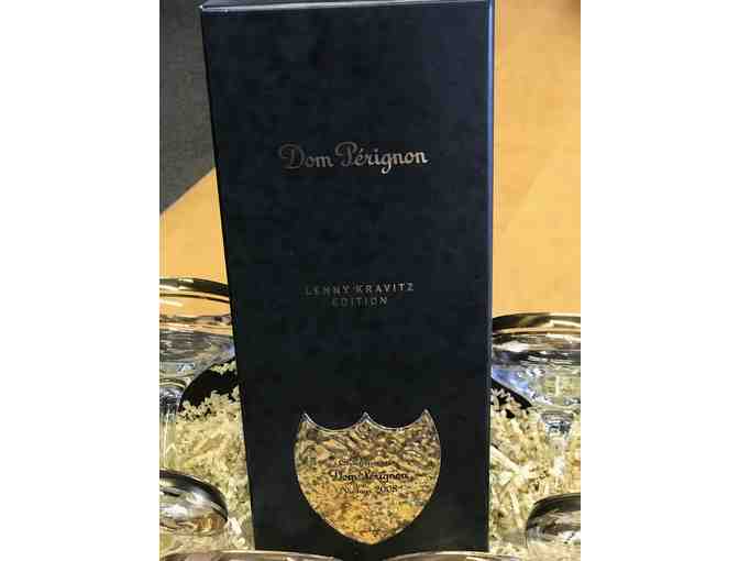 Dom Perignon Special Edition with Champagne Coupes - Photo 2