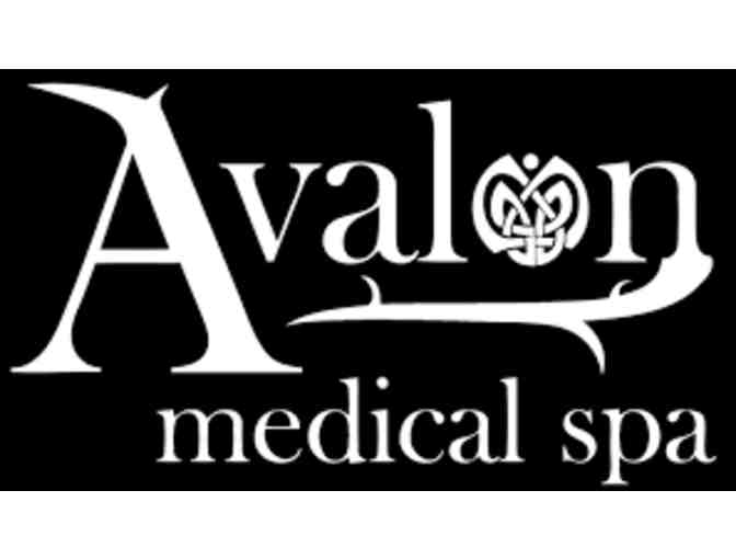 Avalon Medical Spa Chemical Peel - Photo 1