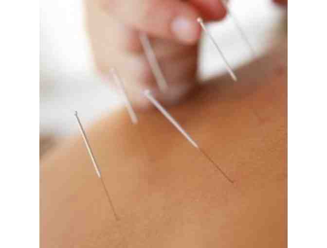 3 Treatments at Oakland Acupuncture Project