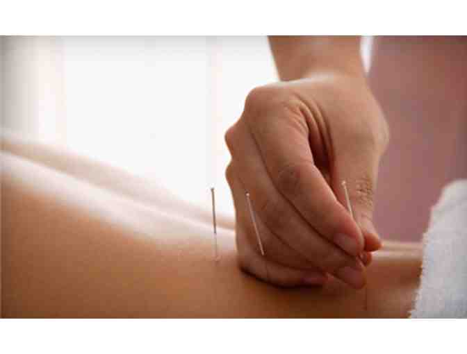 Gift Certificate for One Acupuncture Treatment at Acupuncture and Herb Center