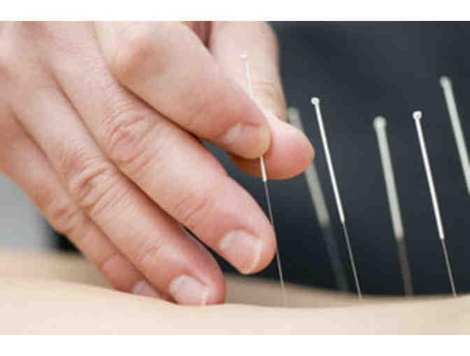Integrated Acupuncture & Herbs- Package of Acupuncture & Cupping!!