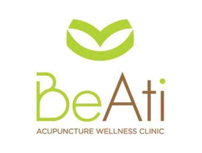 Couples Acupuncture Treatment & Facials with BeAti