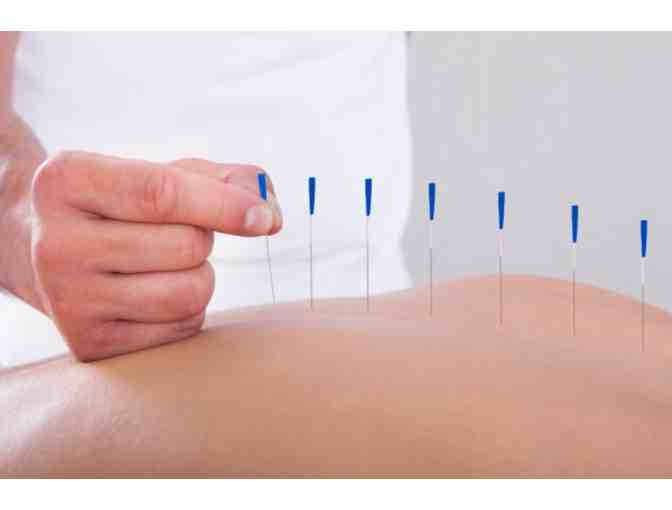 Acupuncture Package