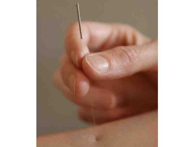 Balance Health + Wellness - acupuncture consult & treatment