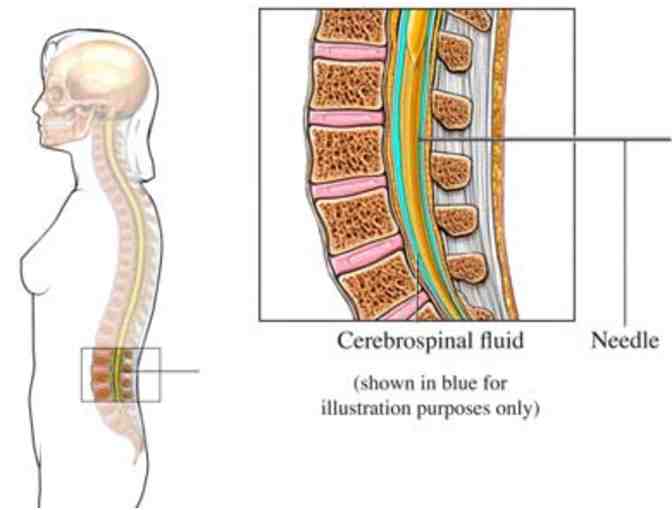 Regulate your Cerebro-spinal fluid. THE HEALING & WELLNESS CENTER, Kent Island. $35 Open!