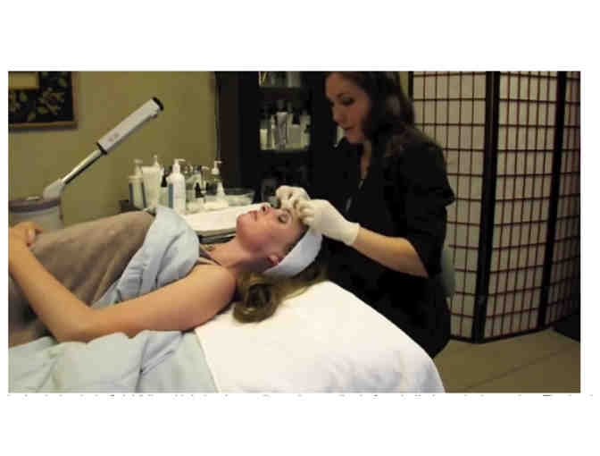Dermaplaning from Surface Medical Spa