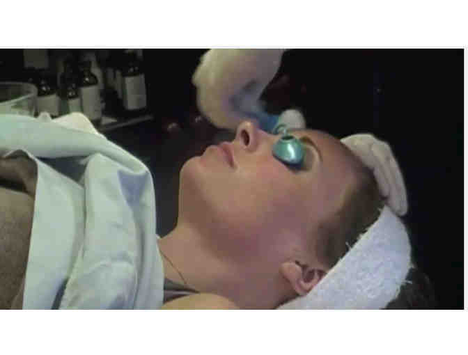 Dermaplaning from Surface Medical Spa