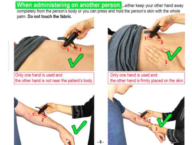 Miracle Trigger Tension Reliever - No Needle No Battery