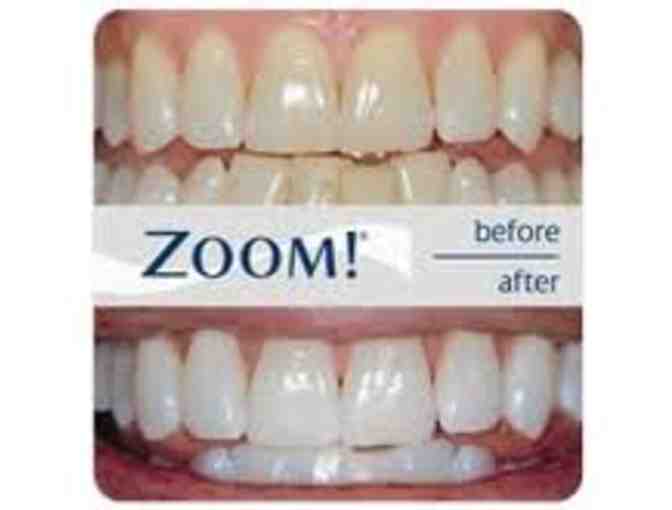 Brighten Your Smile with Zoom Whitening Treatment