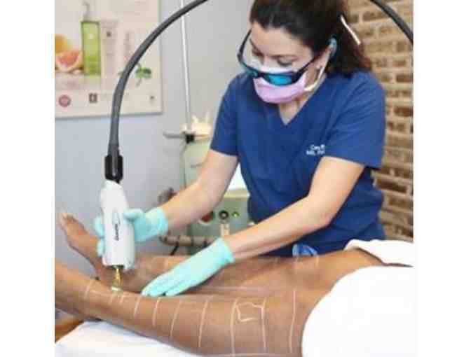 Laser Hair Removal from Lapiel Laser Center