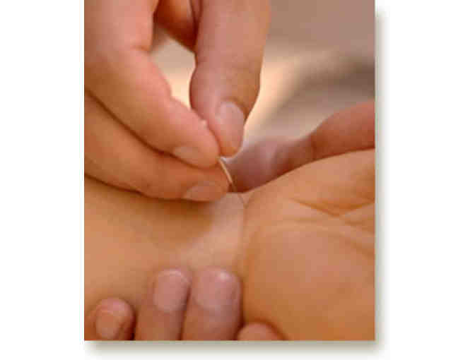 Acupuncture or Dry Needling Session with Exam