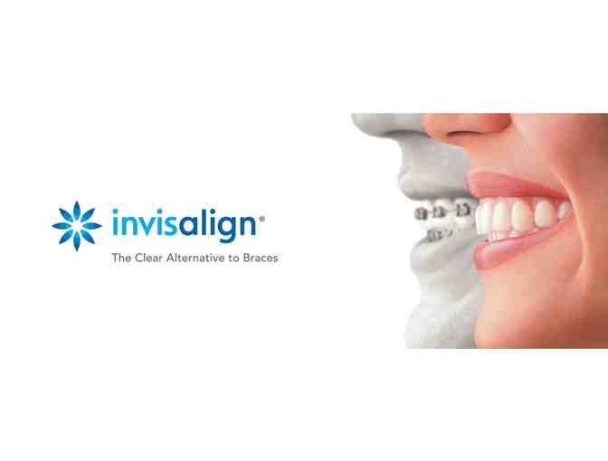 Smile & Show Off Those Pearly Whites with an Invisalign Treatment