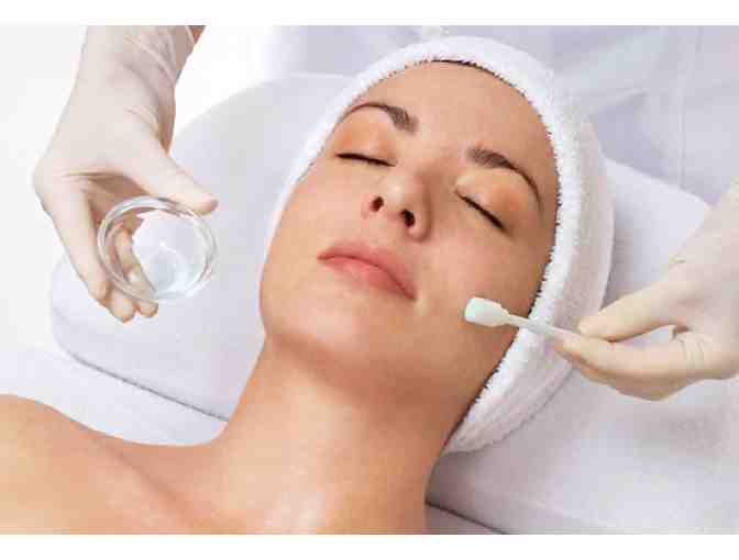 Consultation and Chemical Peel Treatment at CPW Vein and Aesthetic Center