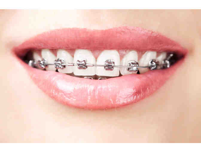 Orthodontic Treatment by Silicon Valley Orthodontics