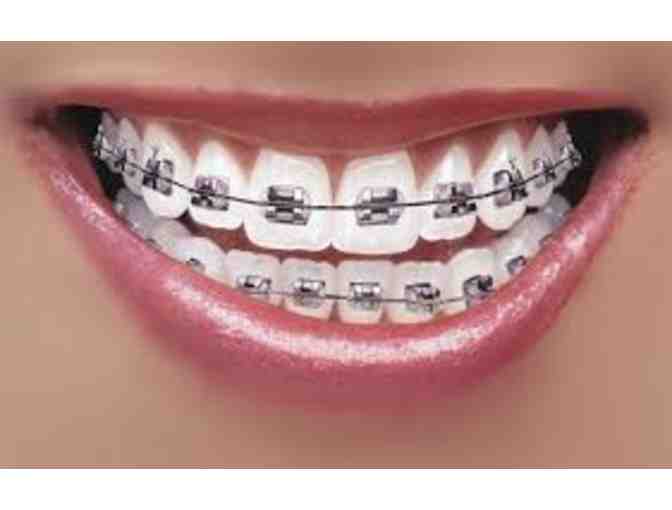 Barkate Othrodontics - $500 Gift Certificate towards Invisalign or Braces