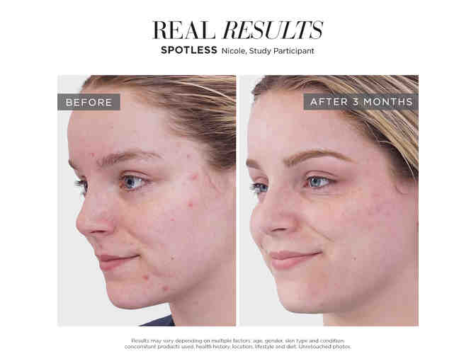 Rodan+Fields Skincare Package