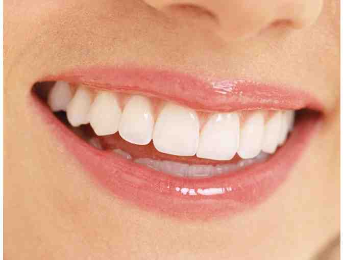 Opalescence Go 15% - Teeth Whitening Kit