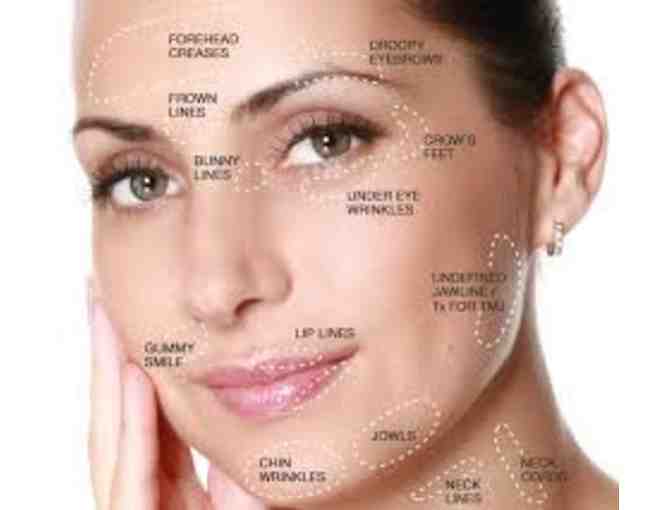 Facial Aesthetics Treatments - 20 Units of Botox Injections