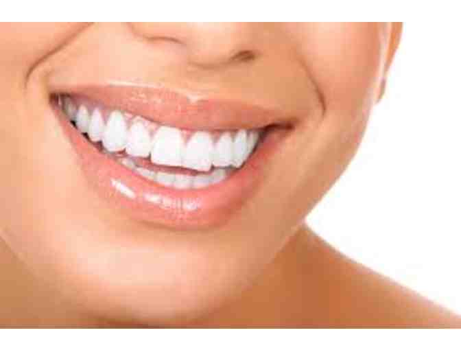 SMILES DENTAL - $250 Gift Card (Teeth Whitening Available!)