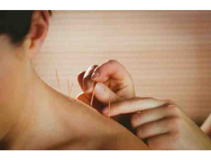 ORA Acupuncture Healing