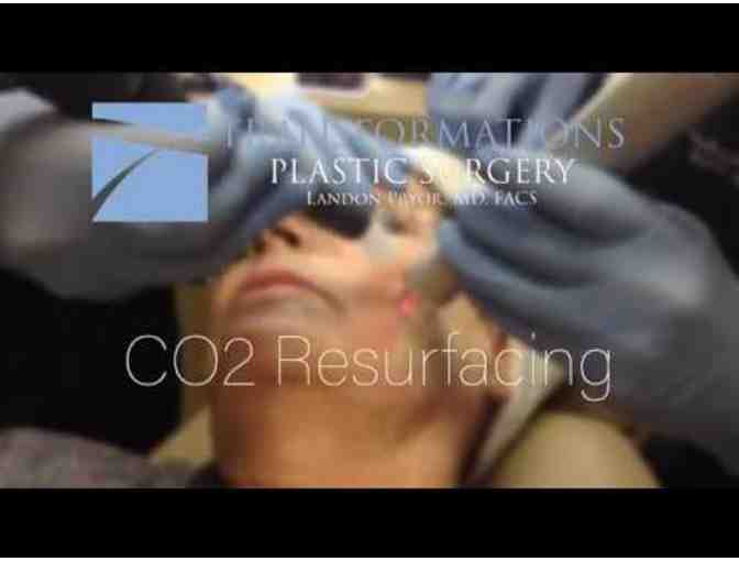 CO2 Resurfacing for Face, Neck & Chest