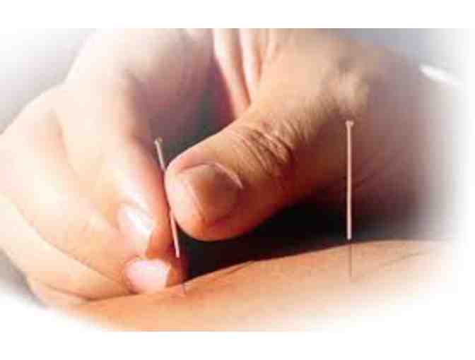 Acupuncture Gift Certificate