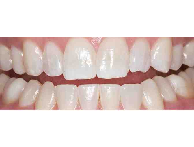 Teeth Whitening Package - Opalescence Boost