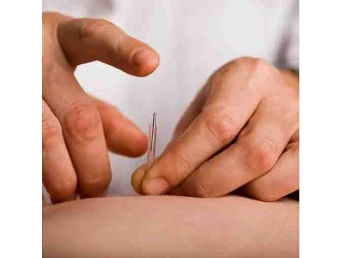 Acupuncture Treatment with Massage