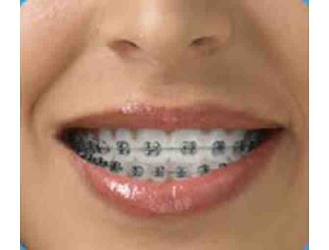 $500 Gift Certificate towards Braces at Ross orthodontics