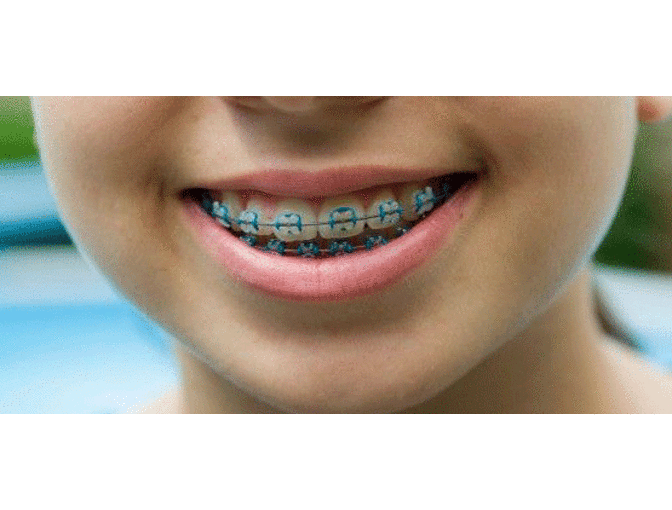 $2000  Gift Certificate towards a New Orthodontic Treatment Plan