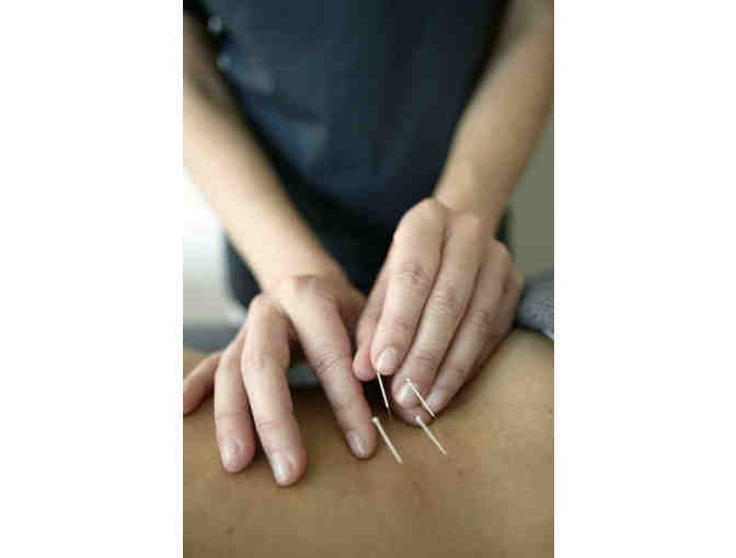 1.5 hr Acupuncture Treatment with Kat Delse Mardirous, L.Ac.