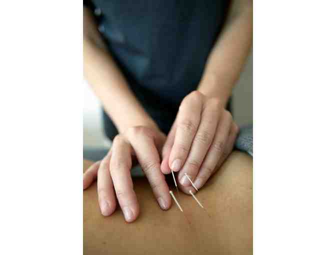 Acupuncture, Reiki & Aromatherapy Session with Kat Delse Mardirous, L.Ac.
