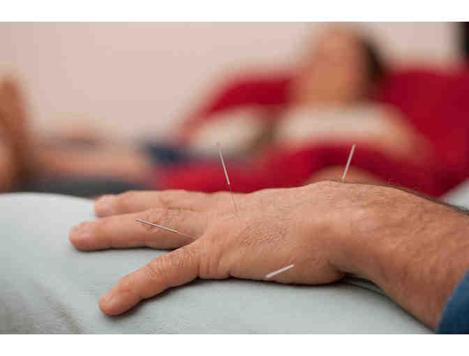 Initial Consultation and Acupuncture + follow-up acupuncture treatment