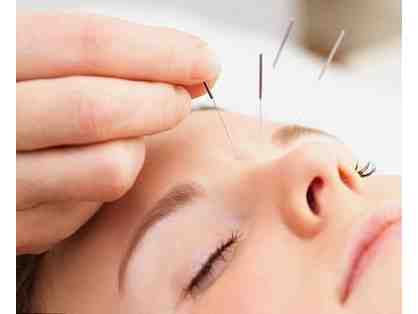 Acupuncture and Reiki treatment at Essence of Acupuncture