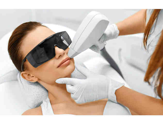 Calabasas Med Spa Laser Hair Removal Treatment