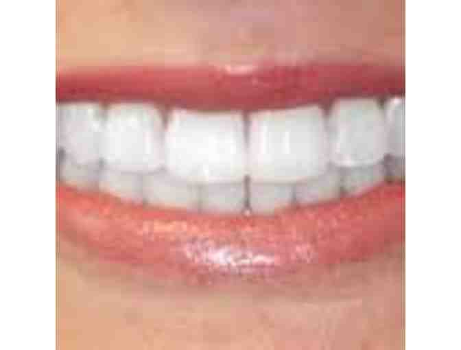 L02. A Perfect Smile