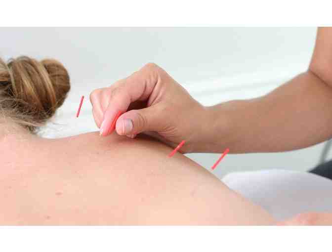 Sage Wellness Acupuncture Consultation and 3 Treatments