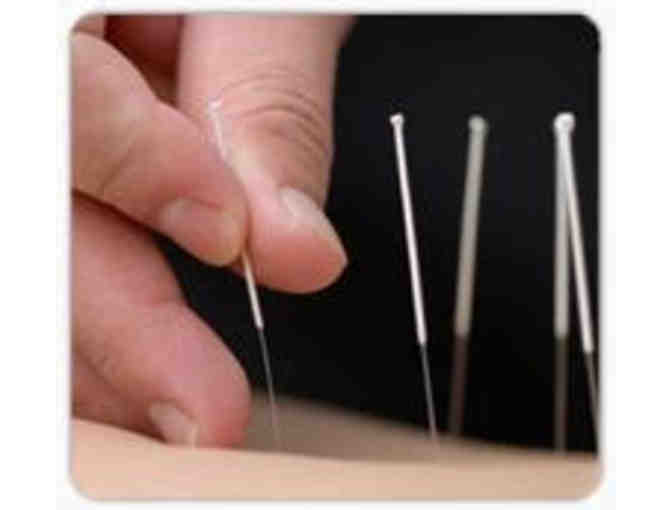 Initial appointment at Acupuncture by Meret