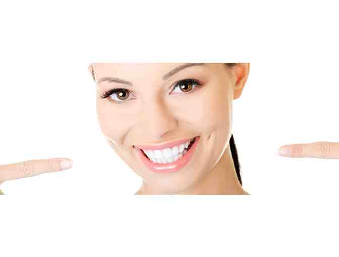 TEETH WHITENING WITH IMMEDIATE RESULTS