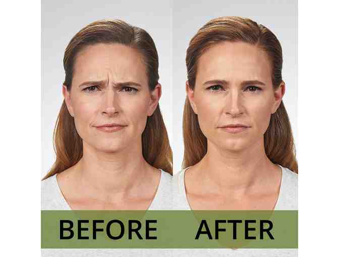 $400 Gift Certificate to Skin and Cancer Associates | Center For Cosmetic Enhancement