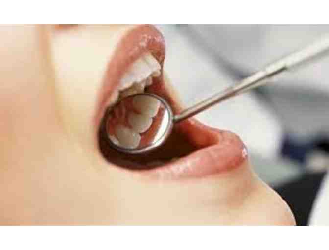 Teeth Cleaning at Nosara Dental