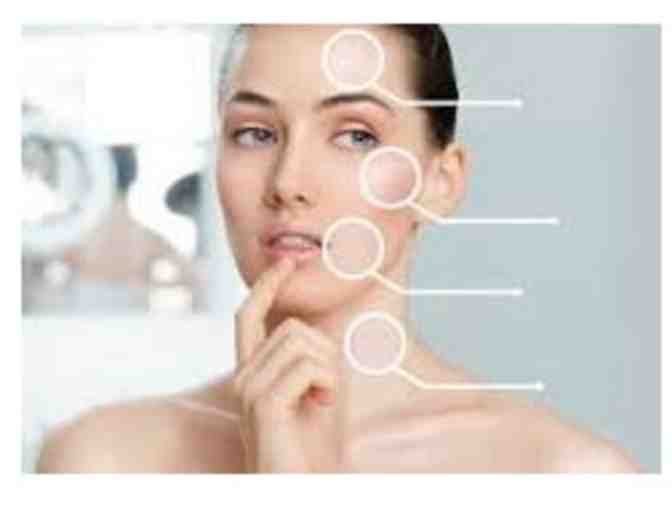 Skin and Facial Consultation with Microdermabrasion - Photo 1