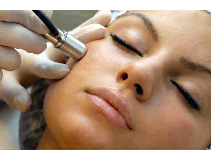 Microdermabrasion (2 of 2)