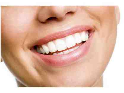 PRICE DROP ALERT: Professional Teeth Whitening: Dr. Tom Ritter, D.D.S.