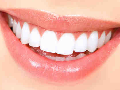 Professional Tooth Whitening System from Dr. Matthew Ballinger, DDS