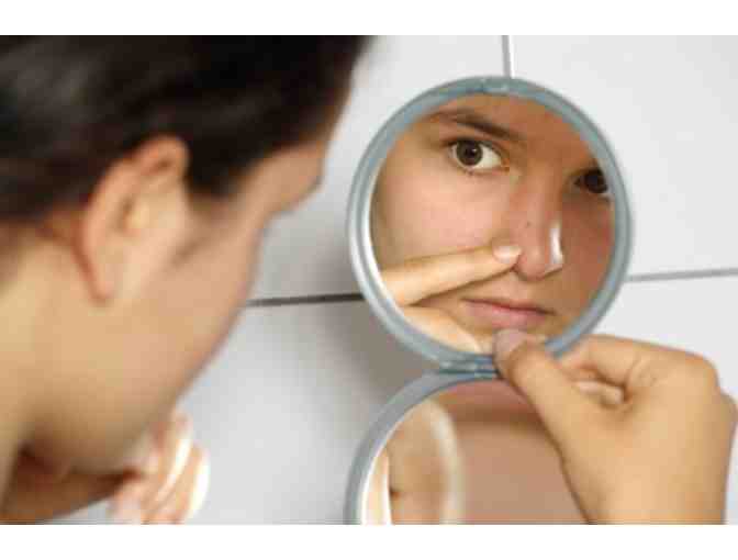 DermaSweep Microdermabrasion & Youngblood Mineral Makeup Consultation