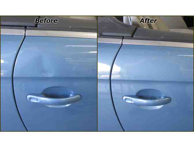 DentHawk Paintless Dent Removal